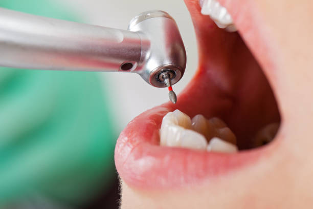 Best Emergency Treatment for Toothache in Marshall, MI